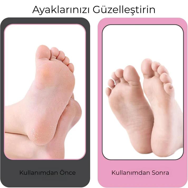 Lavera Ayak Bakım Cihazı